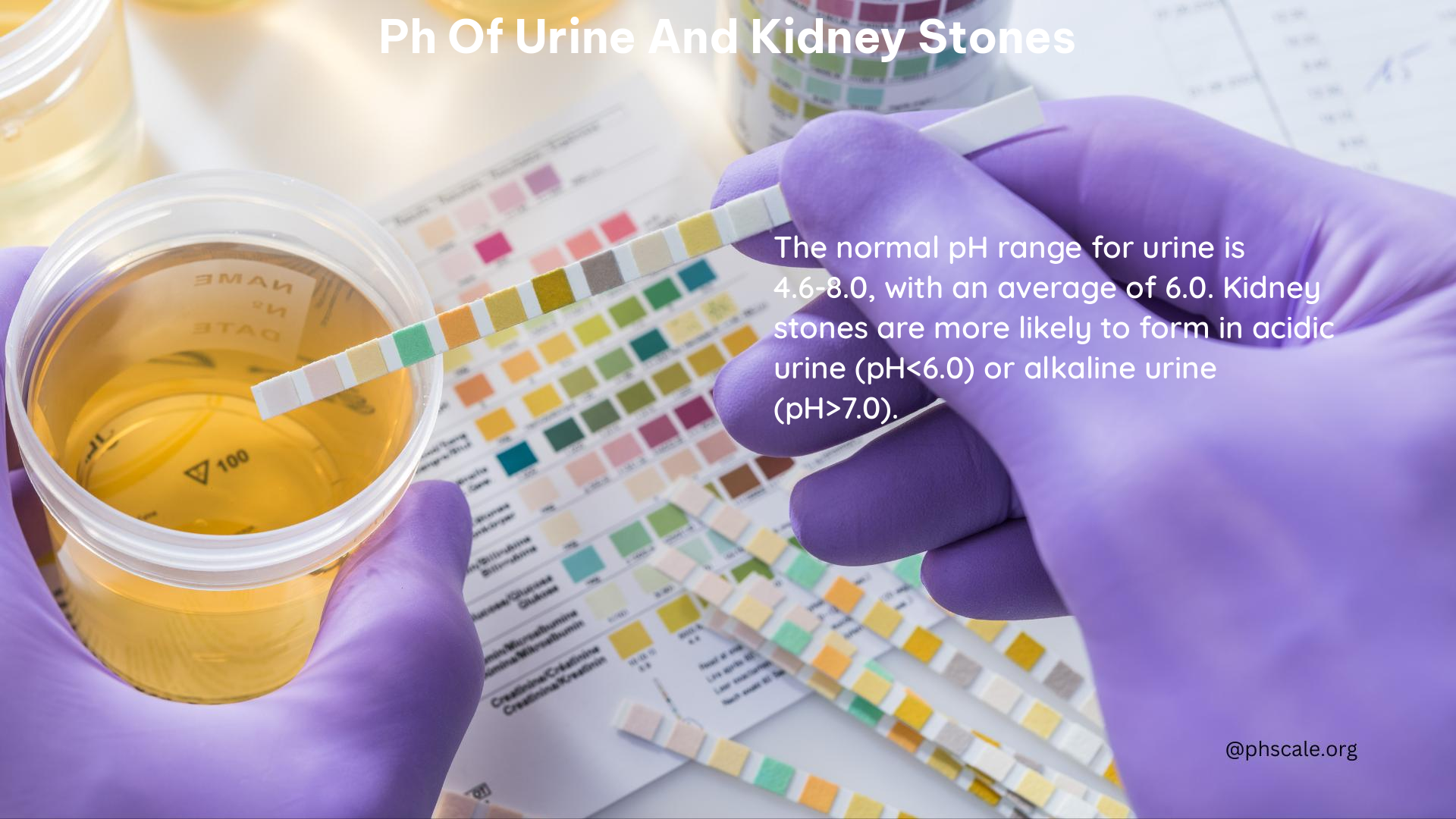 ph of urine and kidney stones