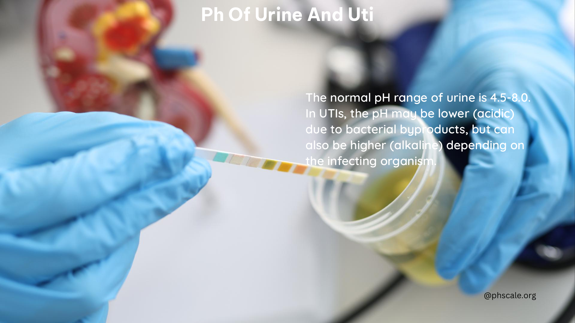 ph of urine and uti